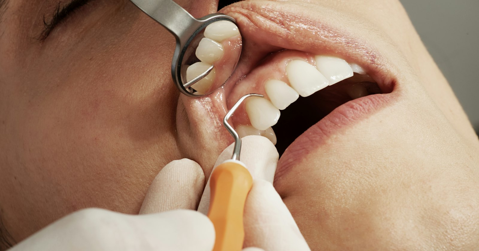 dental checkup with mirror